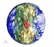 Temperature perturbation for simulation of 3D convection in a density stratified giant planet